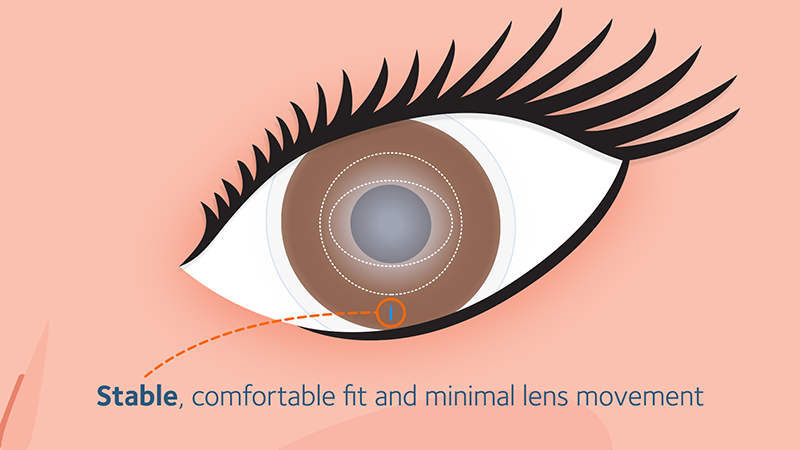 Optimized Toric Lens Geometry™